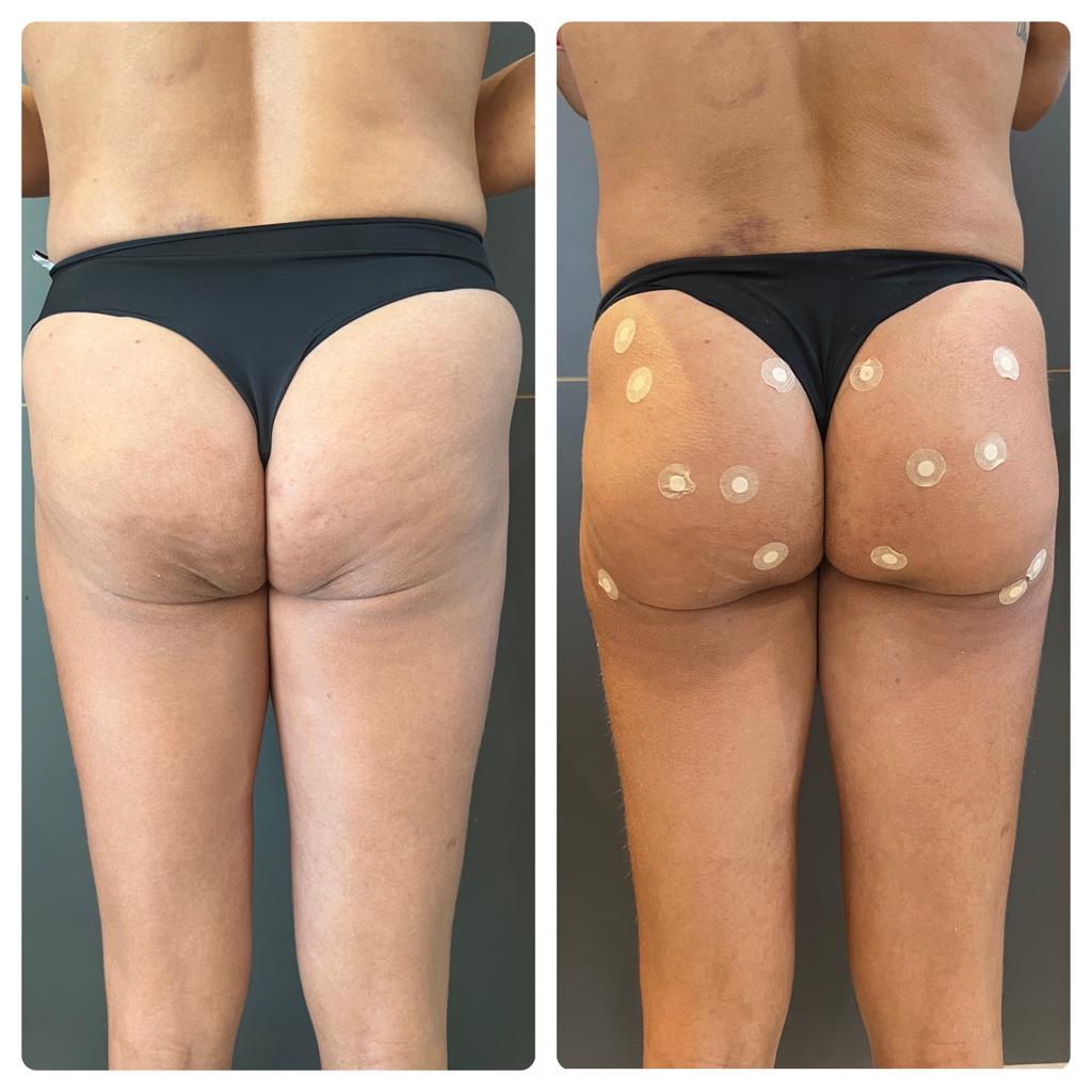 PHOTO-2024-01-12-22-37-28